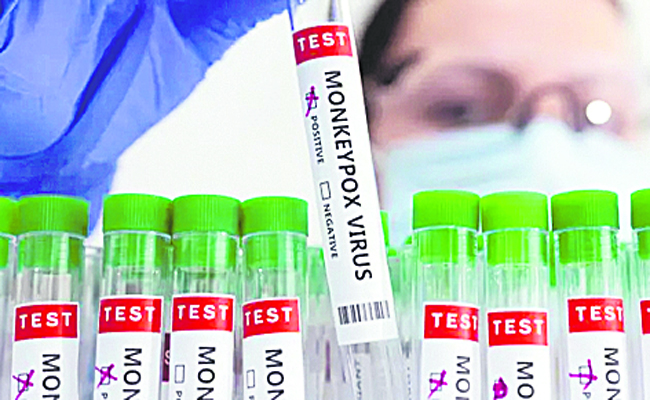 Monkeypox Virus - RTPCR Test kit