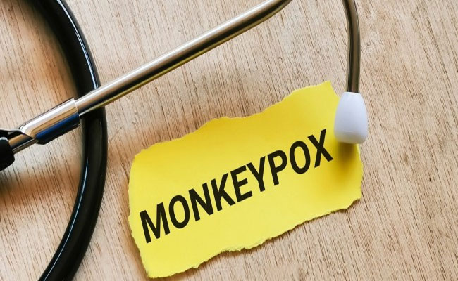 Union Health Ministry issues guidelines on management of Monkeypox disease