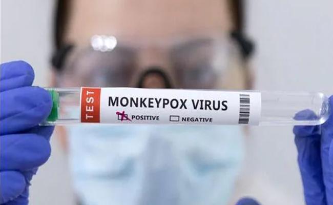 monkeypox virus in india
