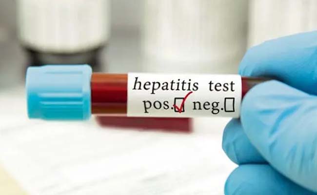 India Ranks Second in Hepatitis B and C Cases Worldwide  WHO 2024 Global Hepatitis Report cover  