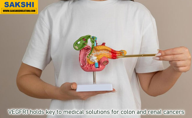 VEGFR1 holds key to medical solutions for colon and renal cancers