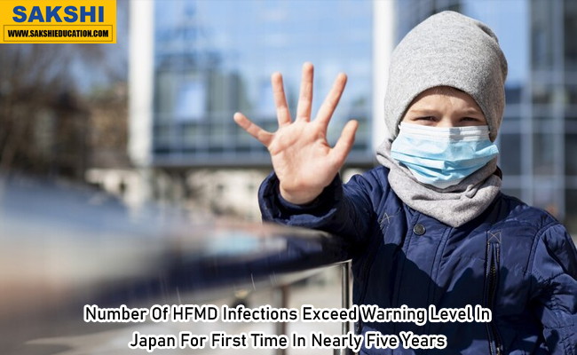 Number Of HFMD Infections Exceed Warning Level In Japan For First Time In Nearly Five Years