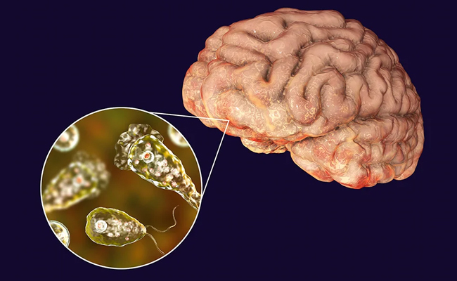 Spread of Brain Eating Amoeba in Kerala