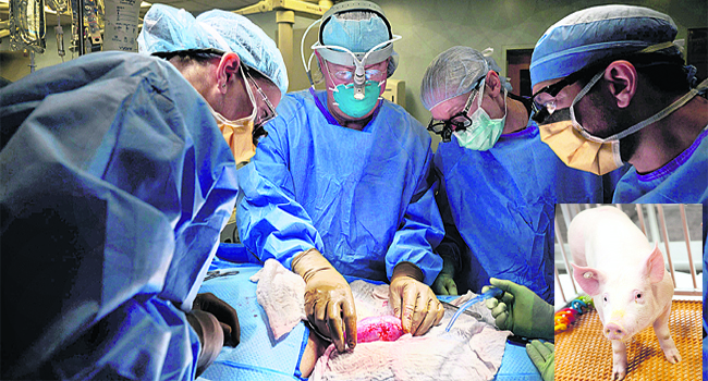 PIG kidney transplant