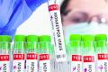 Monkeypox Virus - RTPCR Test kit