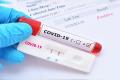 India Logs 656 New Covid-19 Infections    Health Department Reports  Latest COVID-19 Stats  