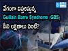 gbs  Symptoms of Guillain-Barré Syndrome  Medical diagnosis and treatment for Guillain-Barré Syndrome